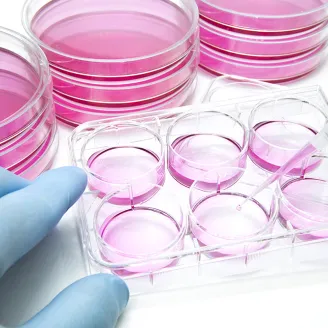 Aliquot of mammalian cells into the 6 well plate